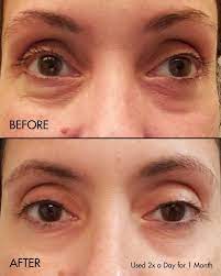 Fermentation Peptine Eye Care Cream Soko Glam Skin Care Wrinkles Eye Care Skin Care Guide