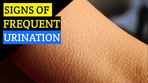 The warning signs may not always be obvious. 10 Warning Signs Of Colon Cancer You Shouldn T Ignore Natural Health Forever Youtube