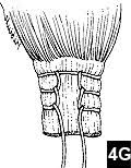 This video demonstrates the krackow stitch. The Krackow Suture How When And Why