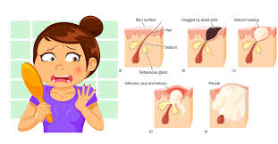 Pin On Health Tips