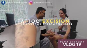 While the treatment is extremely invasive, it is effective. Tattoo Excision Before And After Live Surgery Youtube