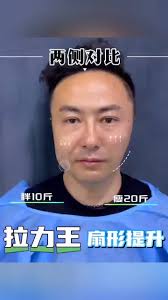 这个对比绝了🙋🏻‍♂️ 男士抗衰这个话题, 最近特别热，因为臭美本无性别之分, #骨线联合