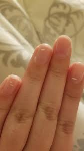The nail color of fingernails and toenails can reveal certain serious health conditions for instance white nails may be indicative of kidney or liver disorders or anemia. Am I Dying I Ve Had These White Spots Constantly Show Up On My Nails Since I Could Remember They Don T Go Away They Have To Grow Out Does Anyone Know What Is