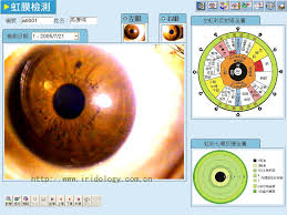 Eye Diagnosis The Eye Si Gh T
