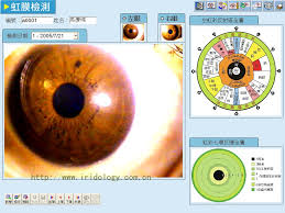 eye diagnosis the eye si gh t