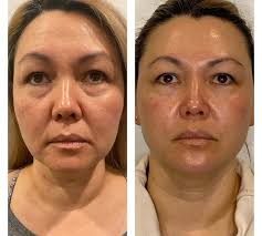 Pure Skin + Wellness