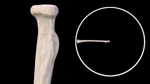 You can find the download links for however, for a long time the research community around surgical simulators has been confronted with a shortage in good quality digital models of the. Radius 3d Anatomy Doc Jana