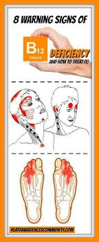 These 8 Warning Signs Show The Lack Of A Very Important Vitamin In Your Body Under No Circumstances You Should Ignore Them Health And Nutrition Vitamins Body Health