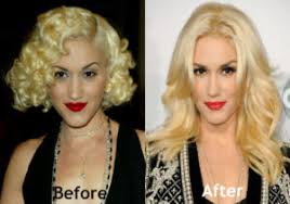 Being the lead singer of . Celebrity Plastic Surgery Gwen Stefani Boob Job Plastic Surgery Before And After Read The Full Story At Http Celebreeties Com Gwen Stefani Boob Jobplastic Surgery Before And After Facebook
