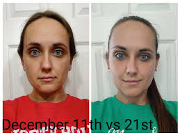 Has anyone had wrinkles around the eyes minimize when using the lymphatic  cream