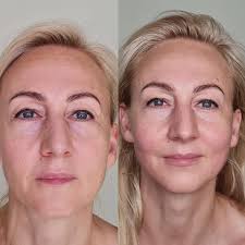 Kobido veido masažas- natūralaus grožio šaltinis ✨ Kobido veido masažas ne  tik atpalaiduoja, bet ir skatina natūralų odos atsinaujinimą, gerina  kraujotaką, mažina raukšles ir suteikia veidui natūralaus spindėjimo  🌿💆‍♀️ Tai ne tik