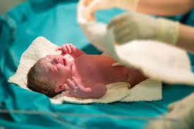 Salah satu keluhan yang juga sering dikeluhkan adalah munculnya nyeri di bagian perut bagian bawah. Kok Kulitnya Begini Jangan Panik Dulu Ini 7 Ciri Fisik Bayi Baru Lahir Bukareview