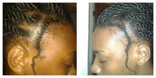 People, myself included, have sworn by the powers of castor oil for edges. Regrow Your Edges Naturally Black Zulu