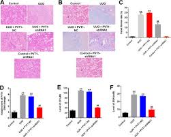 Full article: LncRNA PVT1 Suppresses the Progression of Renal Fibrosis via  Inactivation of TGF-β Signaling Pathway