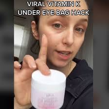 What vitamins are good for under eye bags? Simone Simplybysimone Is Experimenting With Our Vitamin K Creme For Her Hereditary Under Eye Dark Circles In 2021 Under Eyes Dark Circles Vitamin K Cream Vitamin K