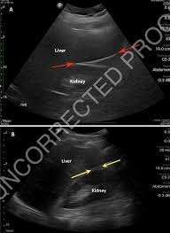 Image result for Lip Exam