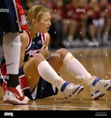 Arizona guard Aimee Grzyb looks in pain in the first half against Stanford  of the finals of the Pac 10 tournament in San Jose, Calif., Monday, March  8, 2004. (AP Photo/Paul Sakuma