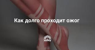 Ckolko Prohodit Ozhog Www Wday Ru