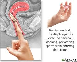 In Depth Reports Birth Control Options For Women