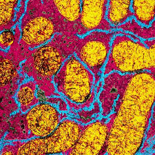 If it carries more cholesterol than the cells can use, too much cholesterol will accumulate, increasing the risk of arterial disease. Liver Cell Innards