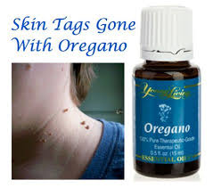 Pin On Essential Oils Some Recipes