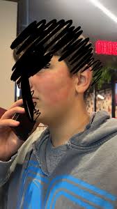 An 'eye-witness' has said that a car hit the footbridge by KFC.