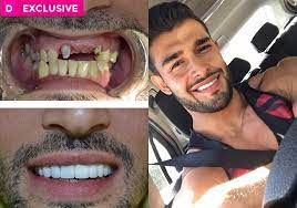Sam asghari has already been hailed as giving britney spears confidence to speak out in court on her conservatorship as she looks to have it removed after 13 years. Exclusive Britney Spears Boyfriend Sam Asghari Before After Dental Work Photos Reveal His Gnarly Teeth The Dirty