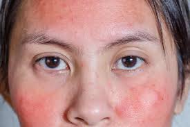 We did not find results for: 12 Penyebab Muka Merah No 12 Paling Sering Doktersehat