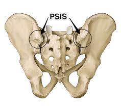 Psis (persatuan sepakbola indonesia semarang) is an indonesian football club based in semarang, central java. Psis Google Search Yoga Anatomy Psoas Release Hip Flexor