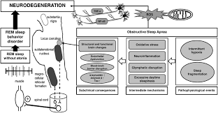 Image result for REM Sleep Behavior Disorder