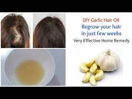 Our hair loss & hair thinning treatment essence can not only effectively promote hair growth, make hair follicle nourishing and active, but also suppress hair just one step to prevent hair loss and promote hair growth,mix every 100ml shampoo with 3ml essence. Incredible Benefits Of Garlic For Hair Femina In
