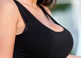 Insurance companies need to be convinced that breast reduction is medically necessary. Breast Reduction Are You A Candidate Cost Recovery Etc