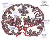 Image result for icd 10 code for left mca cva