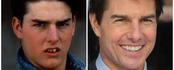 I soldi non fanno la felicità. Ok.