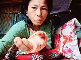 Life's challenges can be overcome with persistence