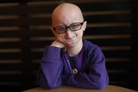 The disease firstly involves premature aging and then death from complications of atherosclerosis such as myocardial infarction, stroke, atherosclerosis, or heart failure. Fda Approves First Drug For Rare Disease That Causes Premature Aging In Children The Boston Globe