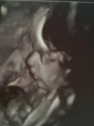My Granddaughter S 4d Scan She Is Due On 15 June 2016 Historical Figures Historical My Travel