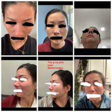 CARA PLASTIC SURGERY & LASER CENTER