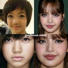 Lisa Manoban then and now #lisamanoban #lalalisa #lalalisamanoban  #lisablackpink #lisablackpink✔️ #jennie #jenniekim #asian #singer #kpop  #beforeandafter #thenandnow #nofilter #makeupideas #monolids  #blepharoplasty #blepharoplastysurgery ...