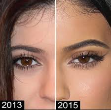 Wondering how to best accentuate your eyes? What Procedure Did Kylie Jenner Get To Change Her Eyes Photo