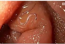 Spesies cacing gelang atau nematod amat sukar dibezakan, dengan 28,000 spesies berlainan telah diterangkan. Puluhan Peneliti Di Cairns Ternakkan Cacing Tambang Di Tubuh Republika Online