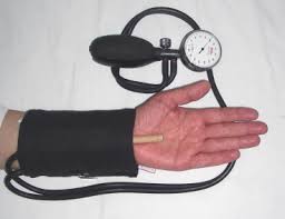Image result for Carpal Compression Test