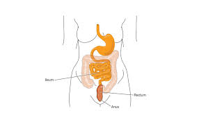 Take action now for maximum saving as these. Colectomy With Ileorectal Anastomosis Ira Ibdrelief