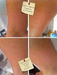 Je Dis Non Au Lumea De Philips Epilateur A Lumiere Pulsee Marinette Saperlipopette Blog Maman Expat A Montreal Et Lifestyle