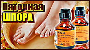 боль в пятке при ходьбе как лечить в домашних условиях Pyatochnaya Shpora Narodnoe Lechenie Pyatochnoj Shpory Bol V Pyatke Pyatochnaya Shpora Zdorove
