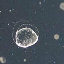 How To Get Rid Of Mites How To Get Rid Of Stuff Hard Water Spots Remove Water Spots Water Spots