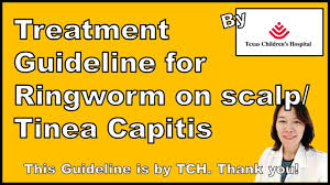 How To Manage Ringworm On Scalp Tinea Capitis Peds Youtube
