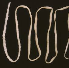 Allerdings werden leider die häufigsten „europäischen parasiten, wie die ascariden (spulwürmer) und der trichuris trichiura (peitschenwürmer) nicht untersucht. Infektion Arzte Ziehen 2 8 Meter Langen Bandwurm Aus Patienten Welt