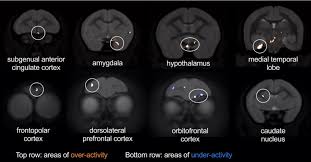 We did not find results for: Single Brain Region Links Depression Anxiety And Heart Disease Healthcare In Europe Com