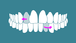 Jul 13, 2021 · whilst the payment plans may seem more attractive, please really do consider if you can afford this and do not over commit yourself. Tech Startups Want To Go Inside Your Mouth Techcrunch